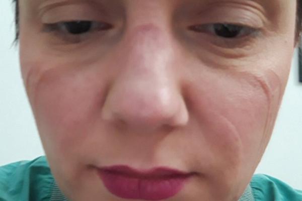 OVA SRPKINJA VEĆ 18 DANA NIJE OTIŠLA KUĆI JER SE BORI ZA ŽIVOTE DRUGIH: Pomozimo joj da se vrati svojoj porodici!