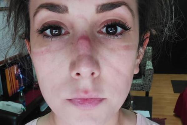 PRELEPA MILICA JE HEROJ SRBIJE: Postoji jedan način da joj svi pomognemo!