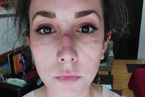 ISPOVEST LEPE DOKTORKE MILICE IZ NIŠA NATERAĆE VAS DA SE ZAMISLITE: Objasnila kako joj je dok leči ljude od korone