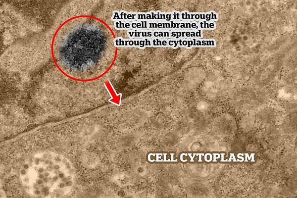 SNIMLJEN MOMENAT KAD KORONAVIRUS ULAZI U LJUDSKU ĆELIJU: Ovako funkcioniše UBICA! (FOTO)