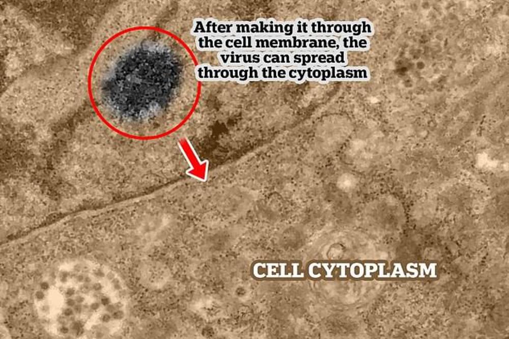 SNIMLJEN MOMENAT KAD KORONAVIRUS ULAZI U LJUDSKU ĆELIJU: Ovako funkcioniše UBICA! (FOTO)