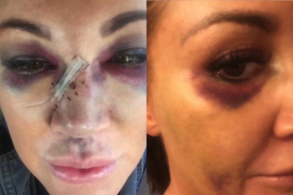 Himna porodičnog nasilja: Riblja čorba - Mi to sve iz ljubavi