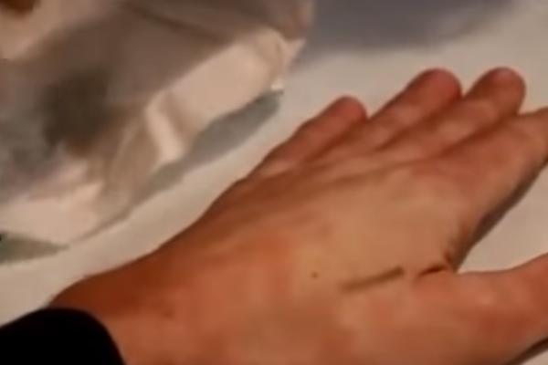 ISPRAVKA: U Švedskoj nije počela ugradnja čipova u ljude, teorije Marata Safina nisu tačne