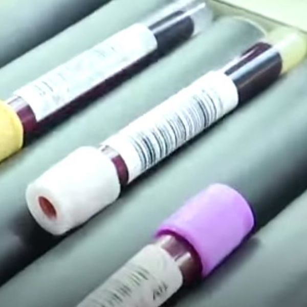 BORIO SE ZA ŽIVOT MESEC DANA, ONDA JE PODVRGNUT TERAPIJI PLAZMOM: Rezultati su fantastični!