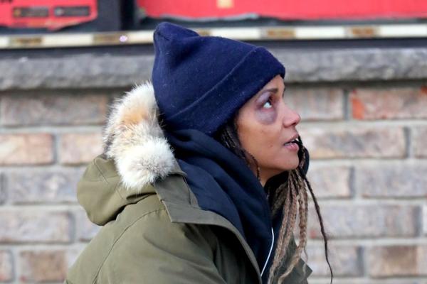 HALI BERI DOBILA BATINE OD MMA ŠAMPIONKE: Polomila mi je nekoliko kostiju! Ona je zver!