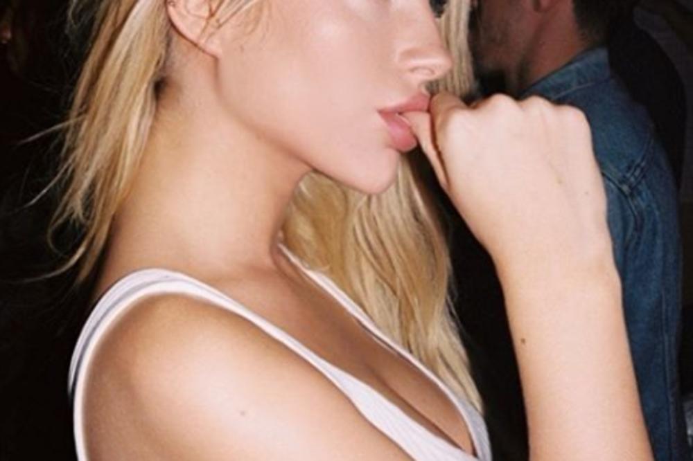 JOJ ŠTA MI SE DESILO U KARANTINU: Sestra čuvene manekenke se SKINULA I POKAZALA SVOJ PROBLEM! (FOTO)