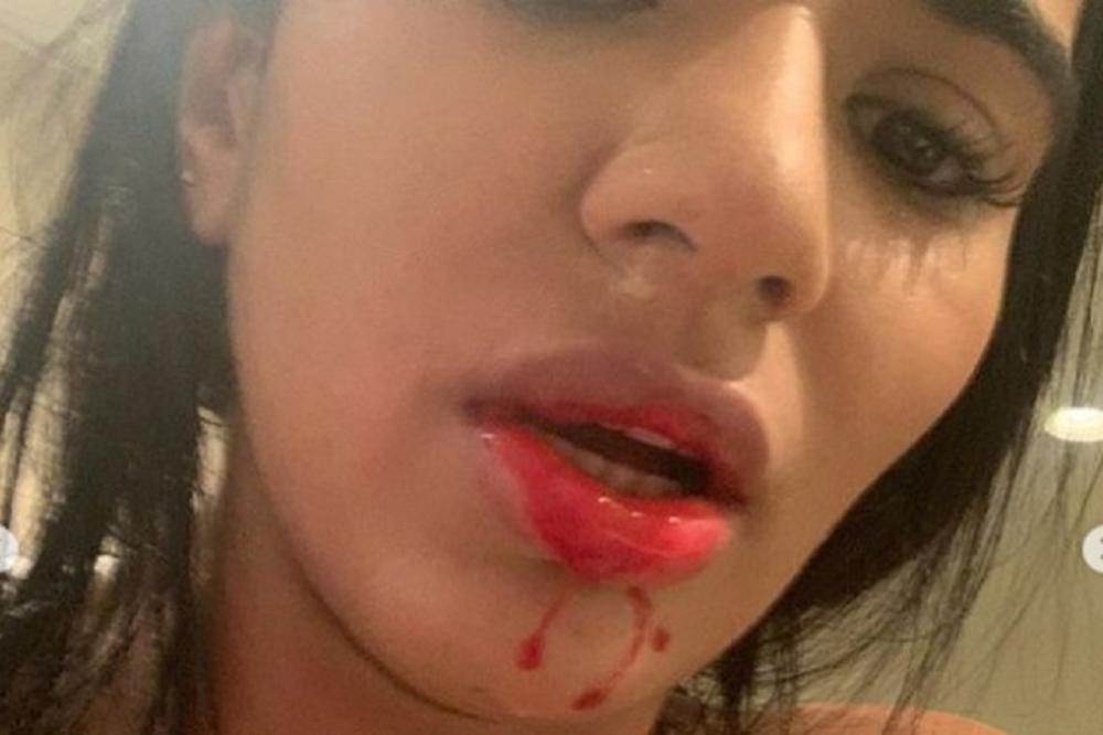 VILJA ISPREBIJAO ŽENU: Krvava i unakažena Danijela moli za pomoć preko Instagrama - on je zver i ološ!