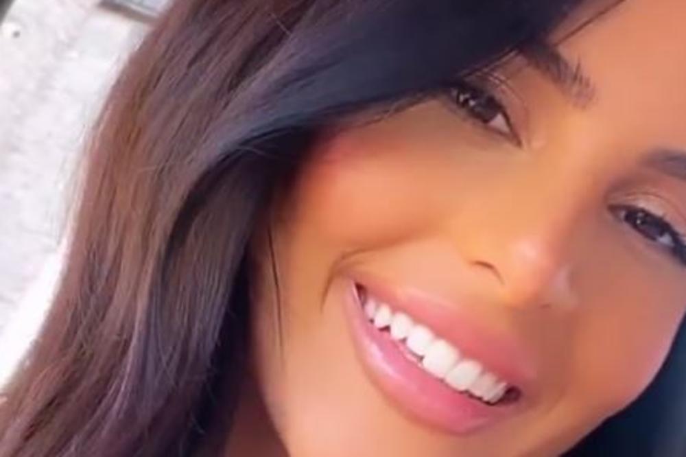 POSLE 2 MESECA U IZOLACIJI ANASTASIJA REŠILA DA URADI PROMENU NA SVOM LICU: Sa ovim izgleda totalno drugačije!