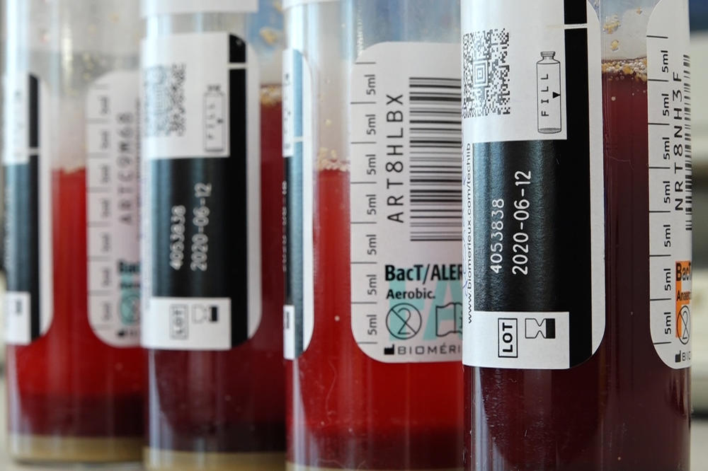 Sombor: Ubrzan proces testiranja na Korona virus