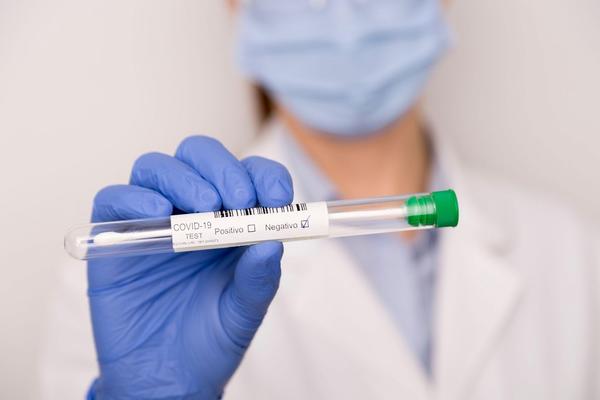 TESTIRANJE NA KORONAVIRUS MOĆI ĆE DA SE OBAVI OD KUĆE: Pacijenti neće morati da ustaju iz fotelje!