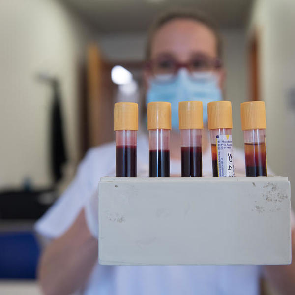 PREMINULE JOŠ DVE OSOBE OD KORONE U SRBIJI: Pozitivno 52, na respiratorima 22