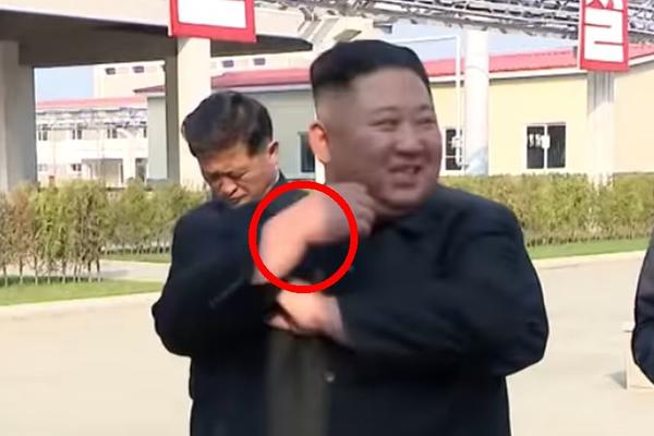 ŠTA JE OVO NA RUCI KIM DŽONG UNA: Da li ovaj detalj otkriva zašto ga nedeljama niko nije video?!