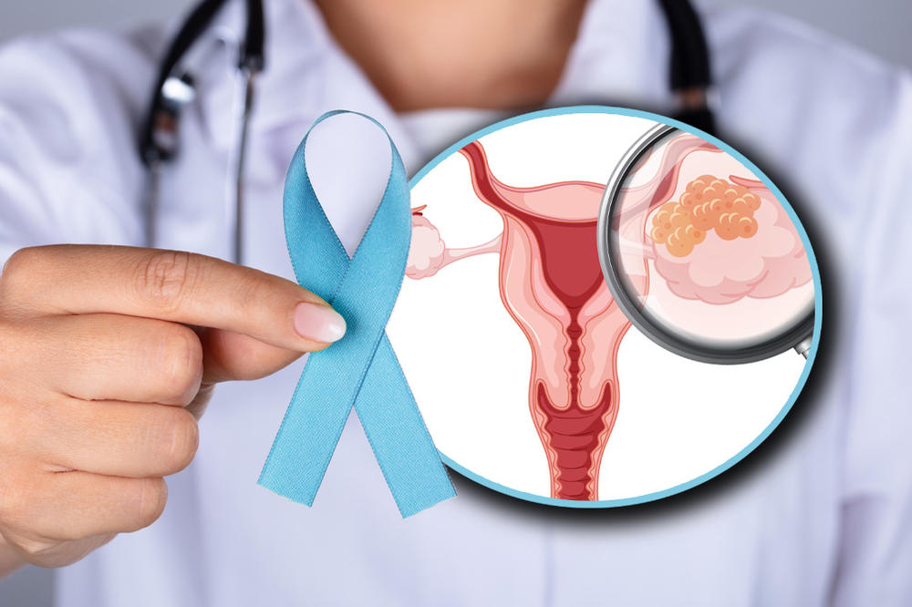 U SRBIJI OD OVE VRSTE RAKA SVAKE GODINE UMRE 450 ŽENA! 5 ključnih činjenica o OVOJ OPAKOJ BOLESTI