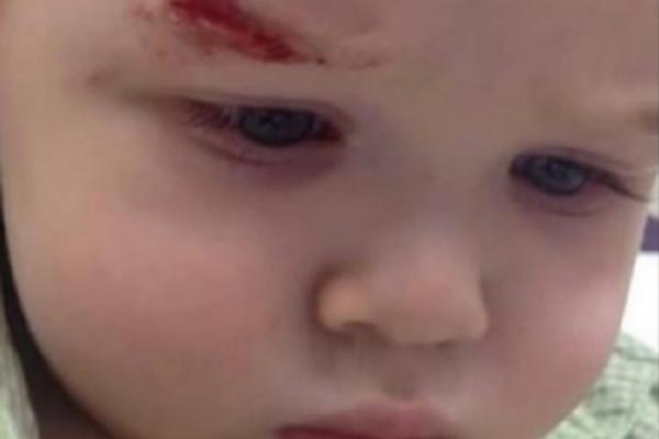 DEČAKU ANDRIJI POLICIJA MILA ĐUKANOVIĆA RAZBILA GLAVU! Ovo je objavljeno svuda, ali je istina sasvim DRUGAČIJA!