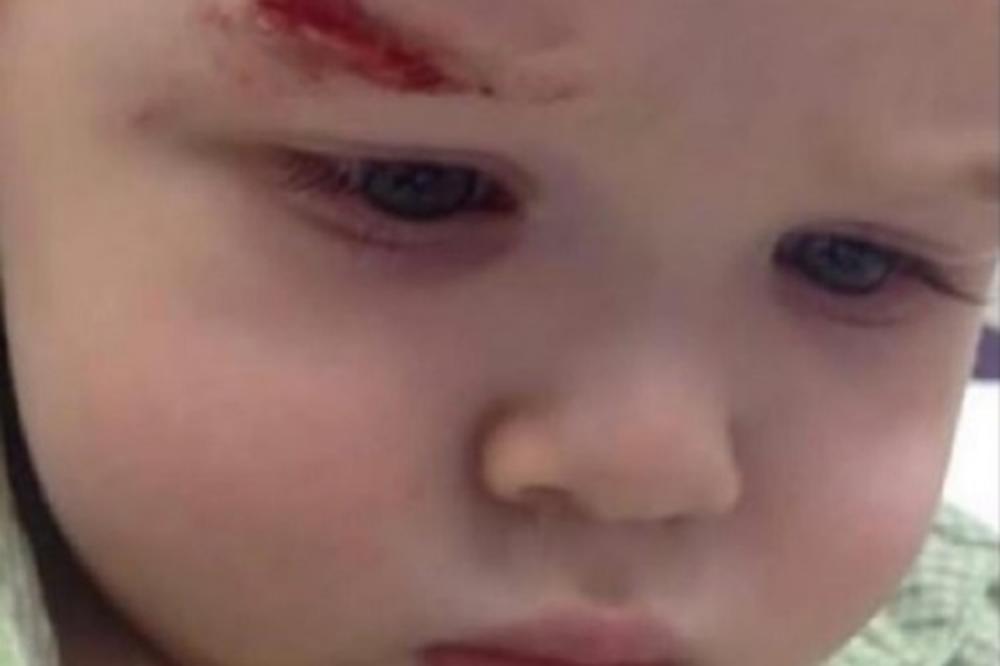 DEČAKU ANDRIJI POLICIJA MILA ĐUKANOVIĆA RAZBILA GLAVU! Ovo je objavljeno svuda, ali je istina sasvim DRUGAČIJA!