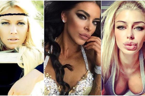 NAŠOJ PEVAČICI MUŽ NAGNJEČIO LOBANJU, GLUMICA JE GODINAMA KRILA NASILJE! Ove poznate dame su pretrpele nasilje!