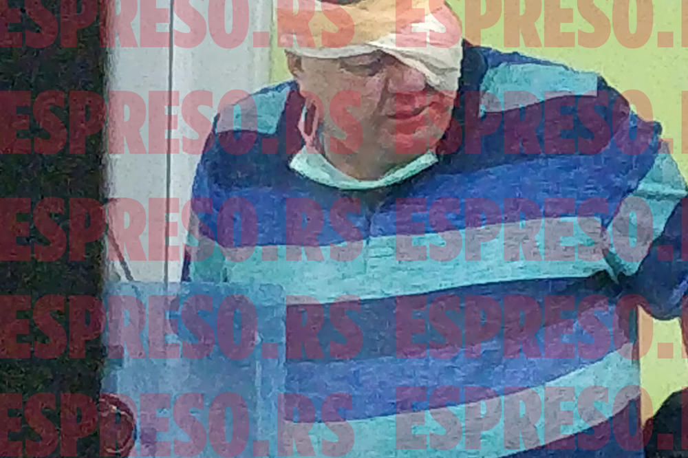 EKSKLUZIVNE FOTOGRAFIJE IZ URGENTNOG: Sudiji u penziji NOVICI PEKOVIĆU huligani su razbili glavu, OVAKO sad izgleda