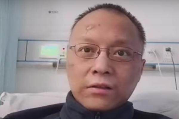 Lekaru iz Vuhana koji je oboleo od korone koža postala POTPUNO CRNA: Pobedio je virus, a pogledajte KAKO SAD IZGLE