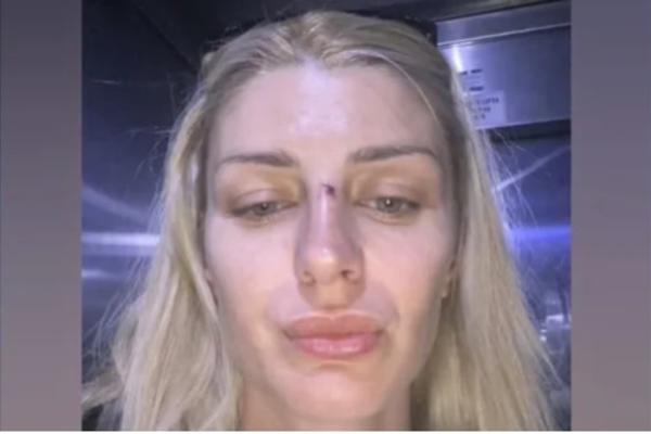 SVI DETALJI PREBIJANJA SANDRE OBRADOVIĆ! Otac njenog deteta je tukao u 4.mesecu trudnoće po stomaku!