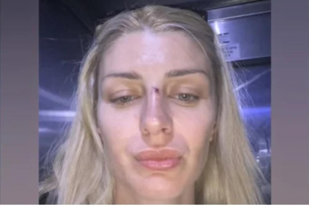 SVI DETALJI PREBIJANJA SANDRE OBRADOVIĆ! Otac njenog deteta je tukao u 4.mesecu trudnoće po stomaku!