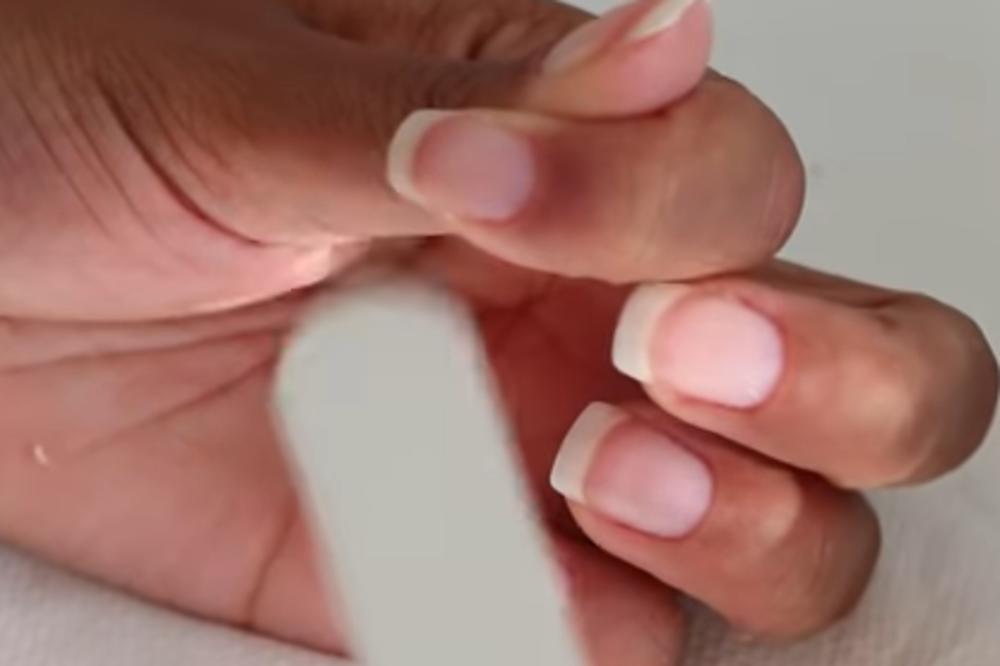 DA LI STE ZNALI NA ŠTA UKAZUJE BELA BOJA NA NOKTIMA: Evo kada je trenutak da se zabrinete!