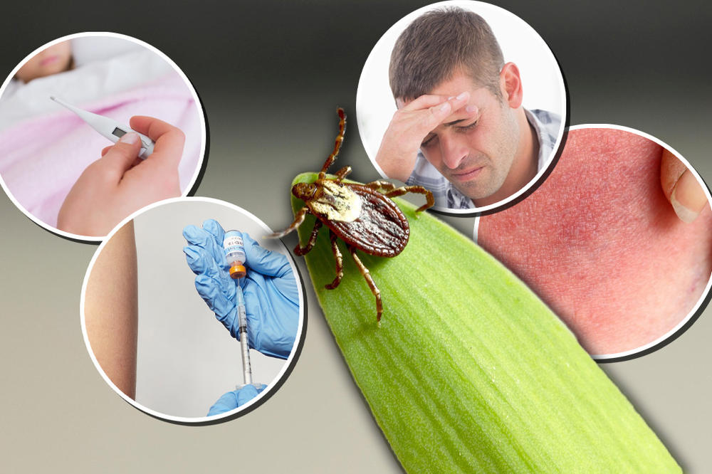 OBRATITE PAŽNJU NA SIMPTOME UJEDA KRPELJA: Obavezno pregledajte OVE delove tela, ali PARAZITA ne vadite sami!