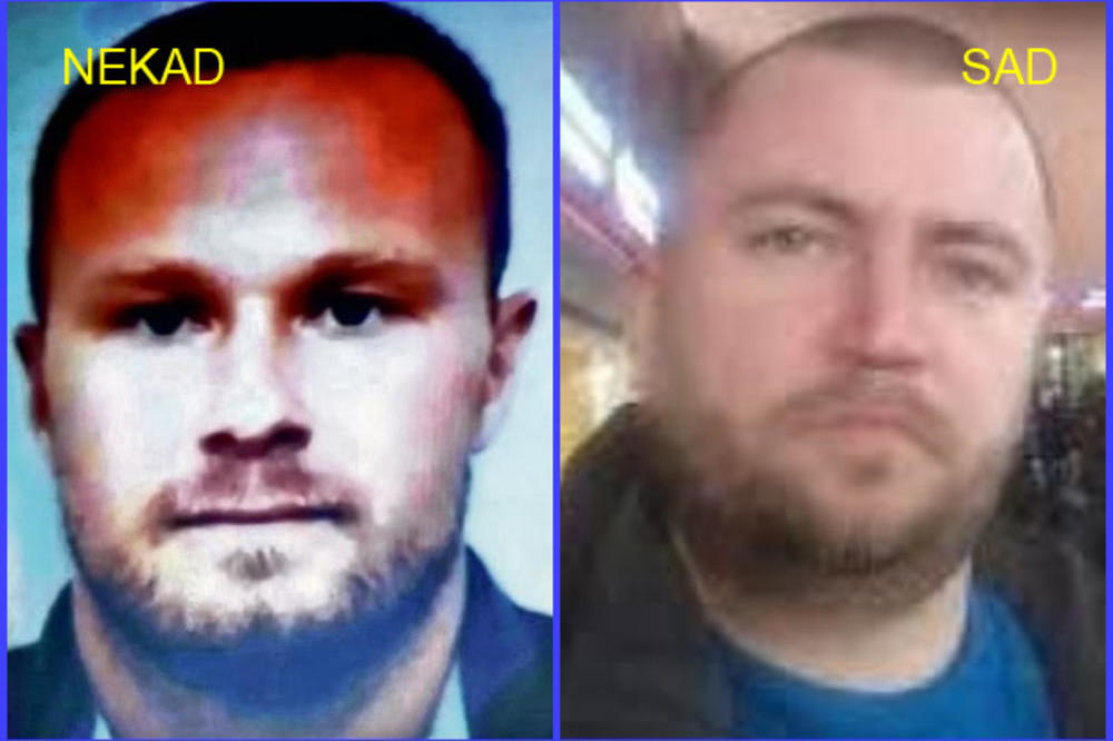 POGLEDAJTE KAKO SADA IZGLEDA RADOJE ZVICER NA KOG JE PUCANO U KIJEVU: U veoma je teškom stanju! (FOTO)