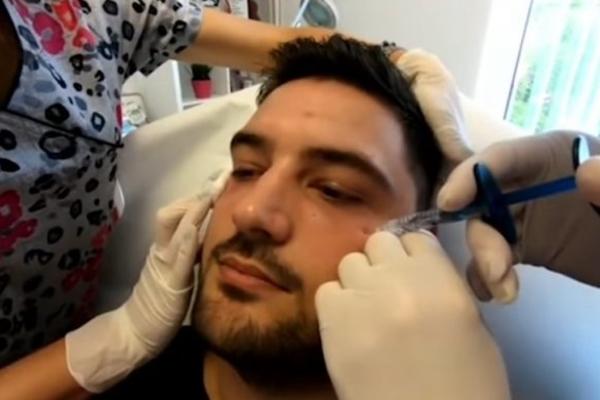 LJUBA PERUĆICA OTIŠAO KOD PLASTIČNOG HIRURGA! Posle ove promene njegova supruga poludela!