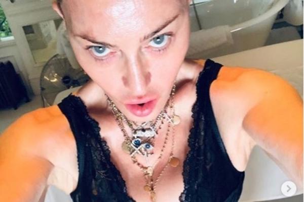 HIRURG REŠIO DA OTKRIJE TAJNU PEVAČICINOG MLADOLIKOG IZGLEDA: ISKEŠIRALA 190.000 EVRA ZA OVE KOREKCIJE?!