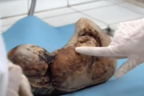 BILA JE TRUDNA, POBEGLA JE IZ BOLNICE: Lekari su se krstili kada su videli šta nosi, sve je snimljeno kamerom!