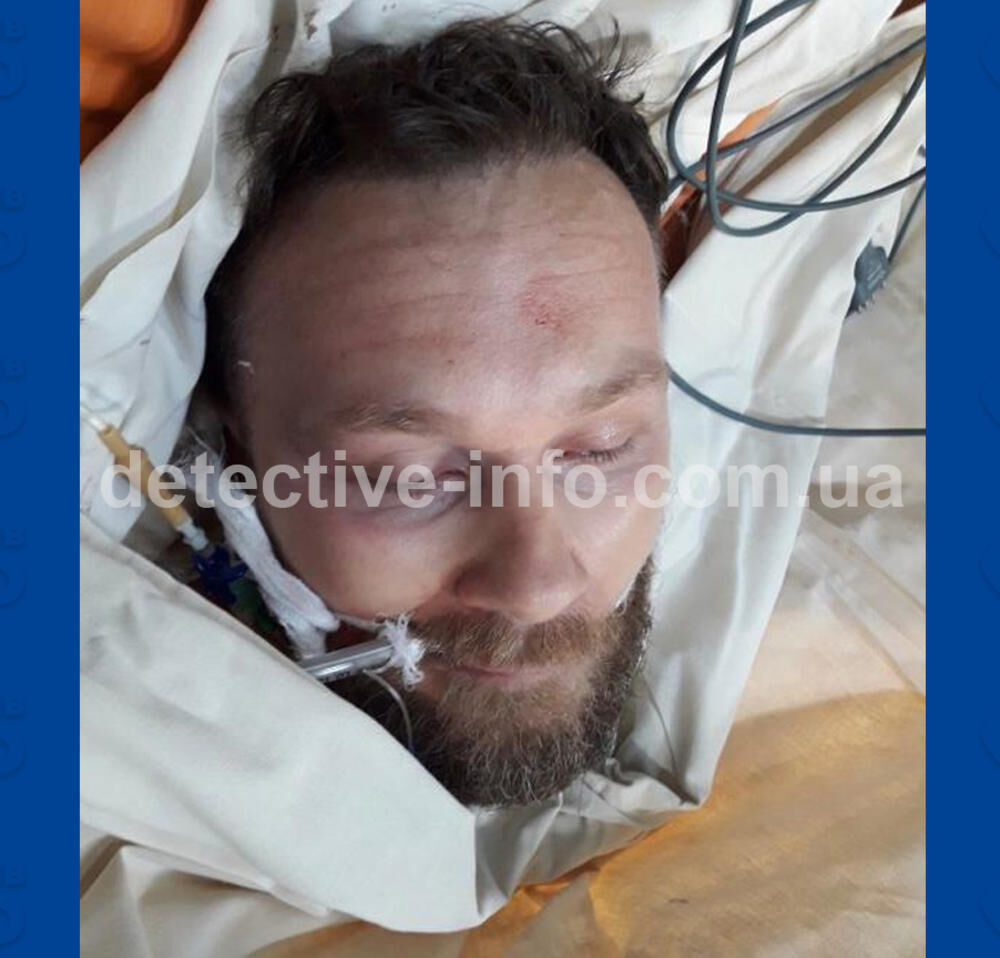 Zvicer u bolnici nakon ranjavanja u Ukrajini