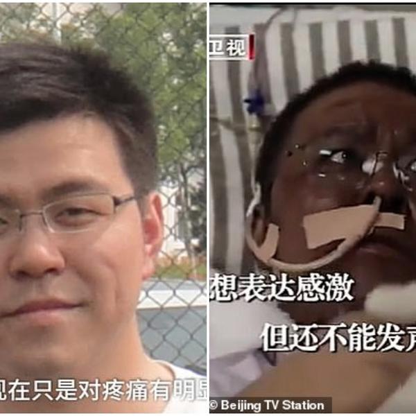 KINESKI LEKARI TAMNE KOŽE PREPLAŠILI SU SVET: Jedan uspeo da se izleči, sada su o drugom doktoru stigle LOŠE VESTI