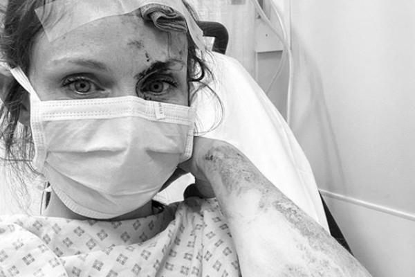 STRAVIČAN UDES ČUVENE PEVAČICE: Ovo je njena PRVA FOTOGRAFIJA iz bolnice! (FOTO)