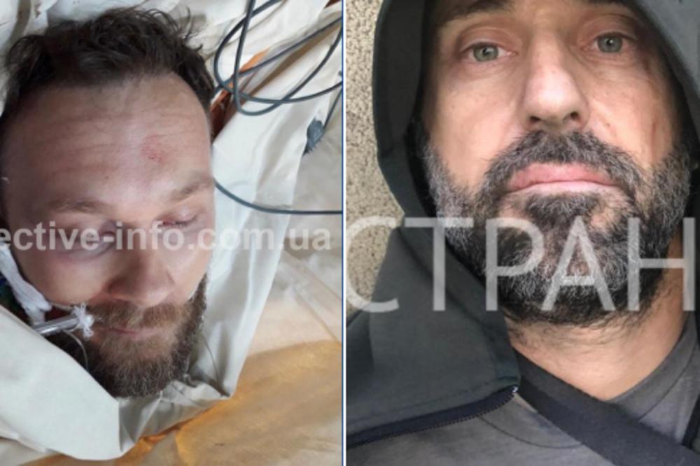 OVO DESNO JE PECA PITBUL: Levo je njegova žrtva iz Kijeva, a danas su otkriveni novi strašni podaci o njemu