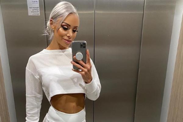 MORALA SAM DA SE UDEBLJAM 10 KG DA POSTANEM SREĆNA: Potresna ispovest lepotice, 1 detalj je posebno zanimljiv!