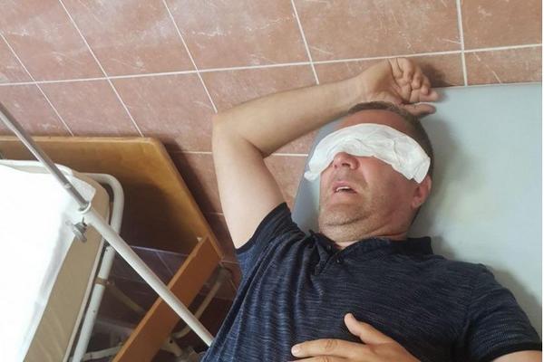 ĐORĐE VUJOVIĆ PREBIJEN I BAČEN SA STEPENIŠTA! Iživljavanje policije u Budvi (VIDEO)