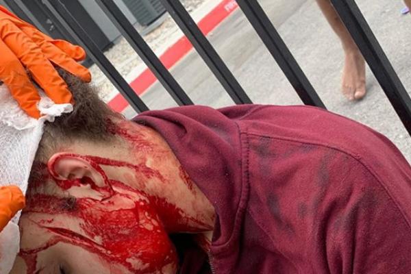 POKOJNI PEVAČ BI SE SADA PREVRTAO U GROBU KADA BI VIDEO ŠTA SU NJEGOVOJ LJUBIMICI URADILI! Krvava, izbodena nožem!