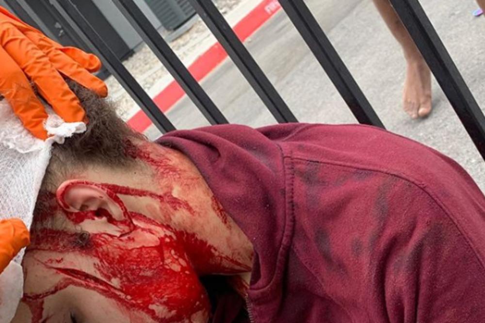 POKOJNI PEVAČ BI SE SADA PREVRTAO U GROBU KADA BI VIDEO ŠTA SU NJEGOVOJ LJUBIMICI URADILI! Krvava, izbodena nožem!