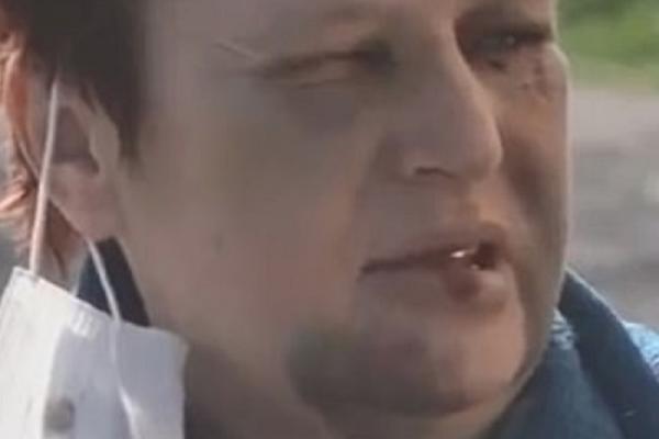 DVA SATA JE MUČILI KAO ŽIVOTINJU! Nina sahranjena živa zbog 60.000 dinara. Bacili je u raku, a ovo je njena priča