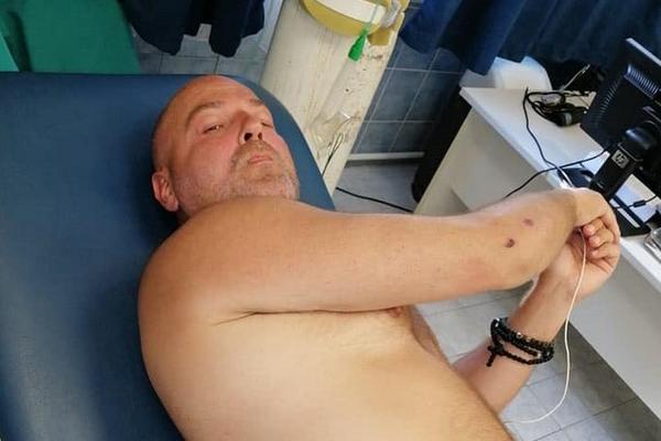 PEĐA RADETIĆ BIO NA METI MILOVE POLICIJE: Brutalno pretučen u Budvi, oštećen mu je vid i ima problema s bubrezima!