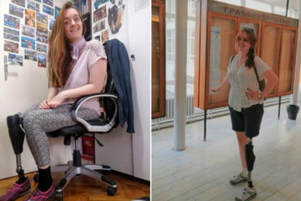 BOJANA JE PRE 4 GODINE PREŽIVELA MASAKR U ŽITIŠTU: U pucnjavi je ostala bez noge, a DANAS SLAVI ŽIVOT (FOTO)