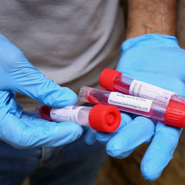 NOVI PODACI SU JAKO ZABRINJAVAJUĆI: U svetu koronavirusom zaraženo više od 25 MILIONA ljudi