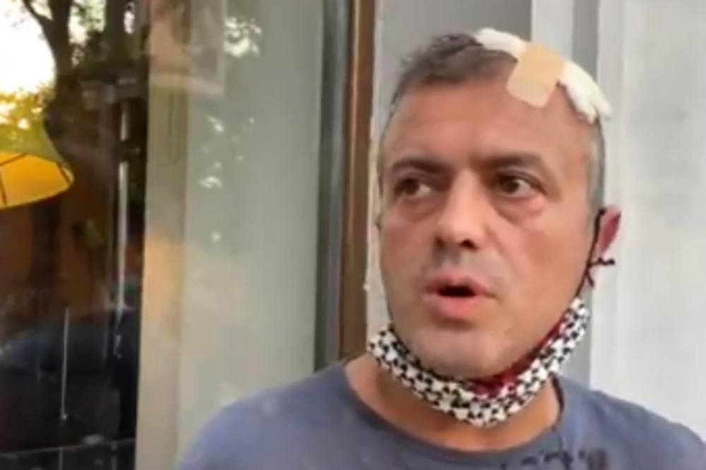 ODJEDNOM SU KRENULI DA ME UDARAJU SA SVIH STRANA! Sergej krvave glave objasnio šta mu se desilo (VIDEO)