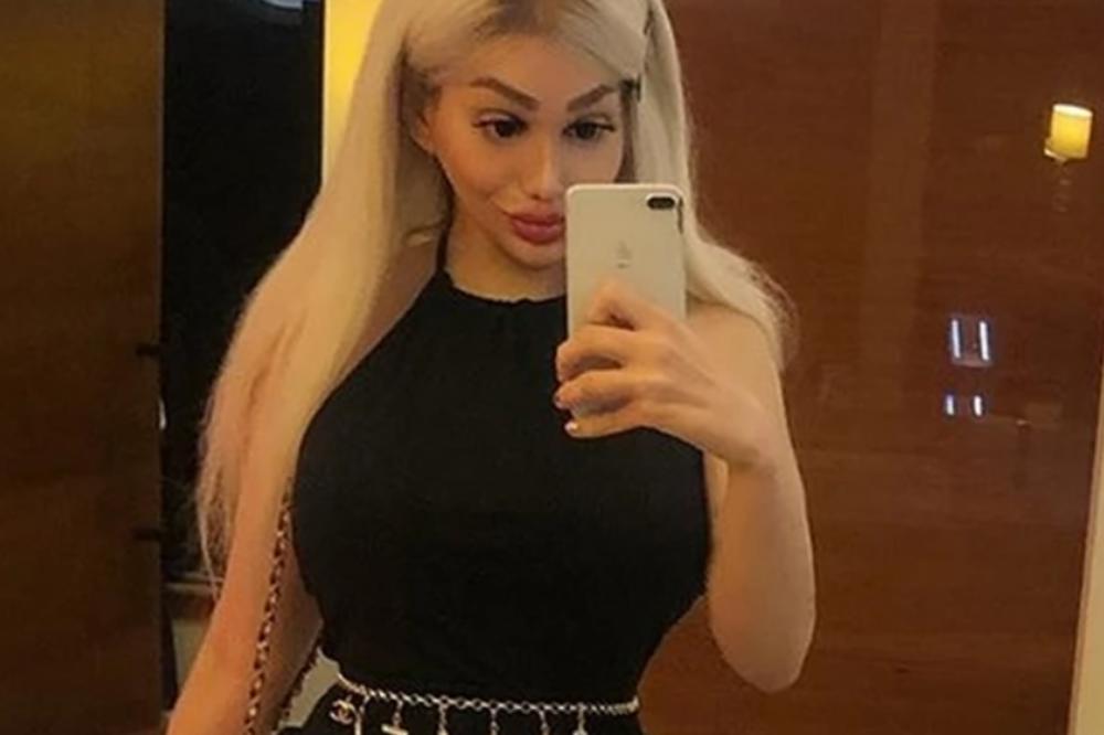 LUNA JE DOBILA OTKAZ JER JE BILA PREVIŠE SE*SI: Povećala je grudi, a onda uradila još DESET OPERACIJA (FOTO)