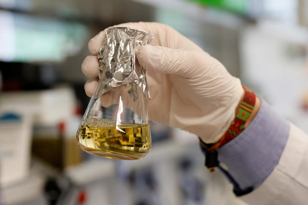 MUŠKARCI BRŽE GUBE ANTITELA NA KORONU! Ovo je upravo objavljeno, otkriveno i od čega ovo ZAVISI