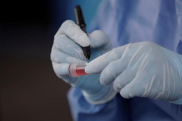 NI MLADI NISU POŠTEĐENI: Jedan faktor je ključan zašto su podložni oboljevanju od korone