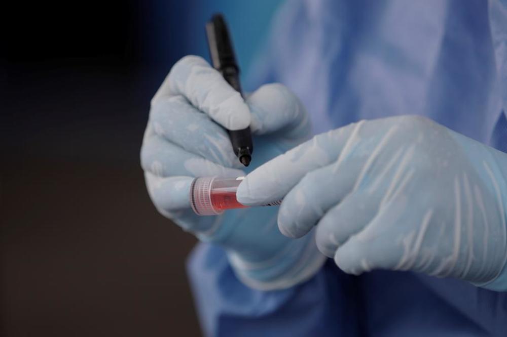 NI MLADI NISU POŠTEĐENI: Jedan faktor je ključan zašto su podložni oboljevanju od korone