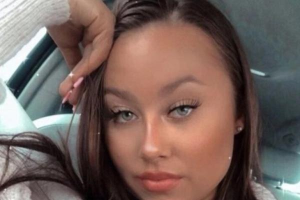 GRUDNJAK JOJ SPALIO GRUDI! Počela je da VRIŠLI KOLIKO JE PEKLO - Objavila UŽAS FOTKE, sva je u OŽILJCIMA!