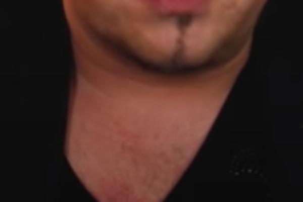 NAŠ POZNATI PEVAČ ZA DLAKU IZBEGAO JEZIVU SMRT! Metak je mogao da mu raznese mozak!