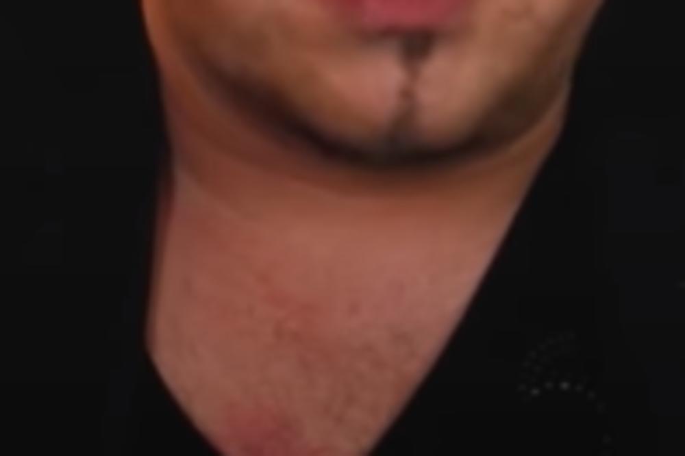 NAŠ POZNATI PEVAČ ZA DLAKU IZBEGAO JEZIVU SMRT! Metak je mogao da mu raznese mozak!